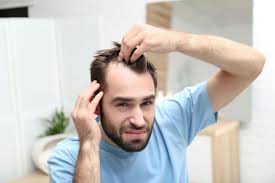 Hair Loss Treatments with Generic Propecia